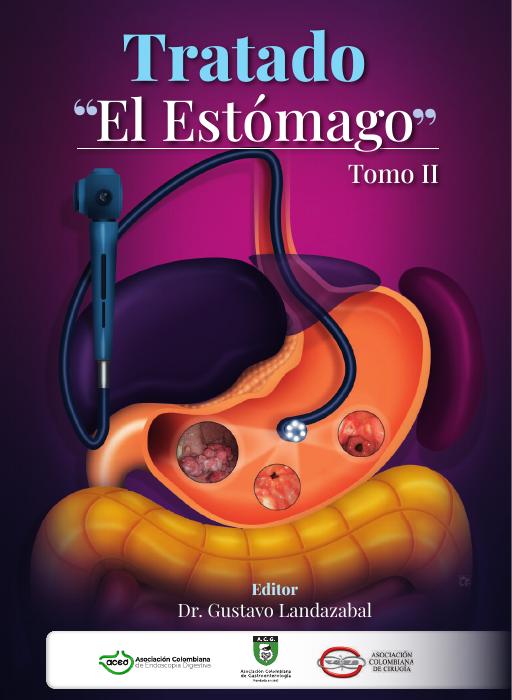 Ultrasonido endoscópico en lesiones malignas gástricas