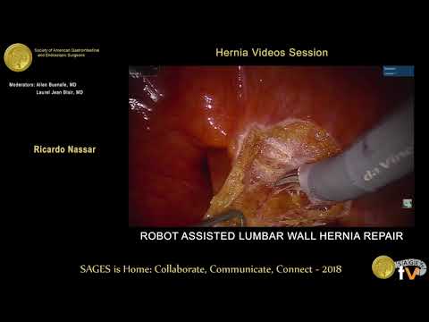 Robot Assisted Lumbar Wall Hernia Repair